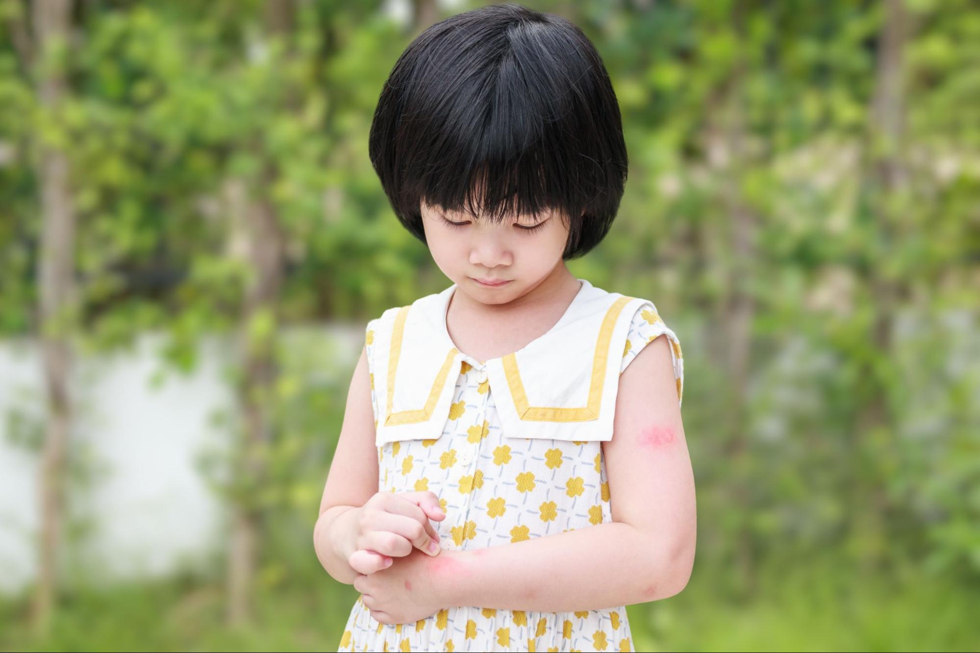 Bé không hợp sữa công thức có thể do dị ứng Bé không hợp sữa công thức có thể do dị ứng